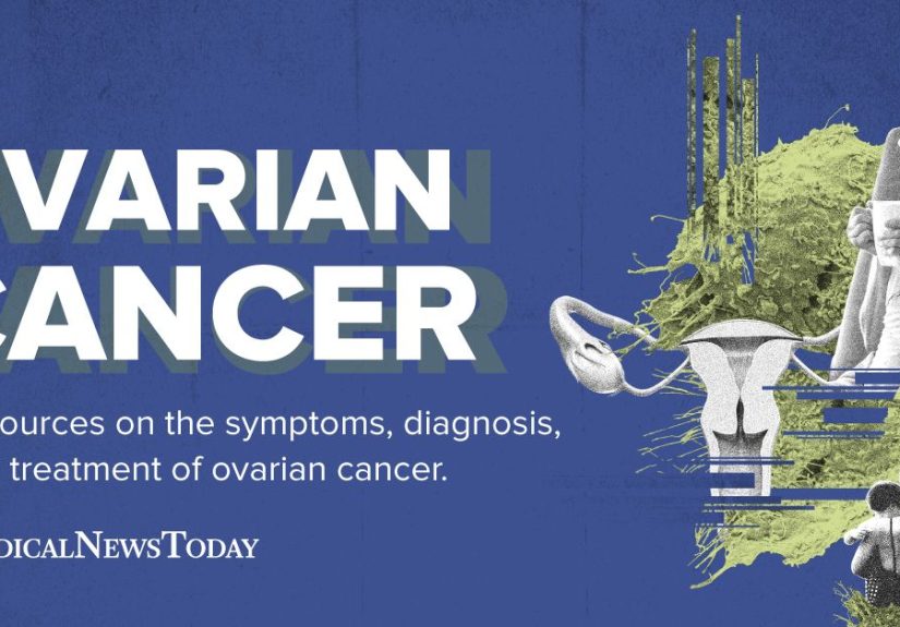 Ovarian Cancer: Resources on Signs, Symptoms, and Treatment