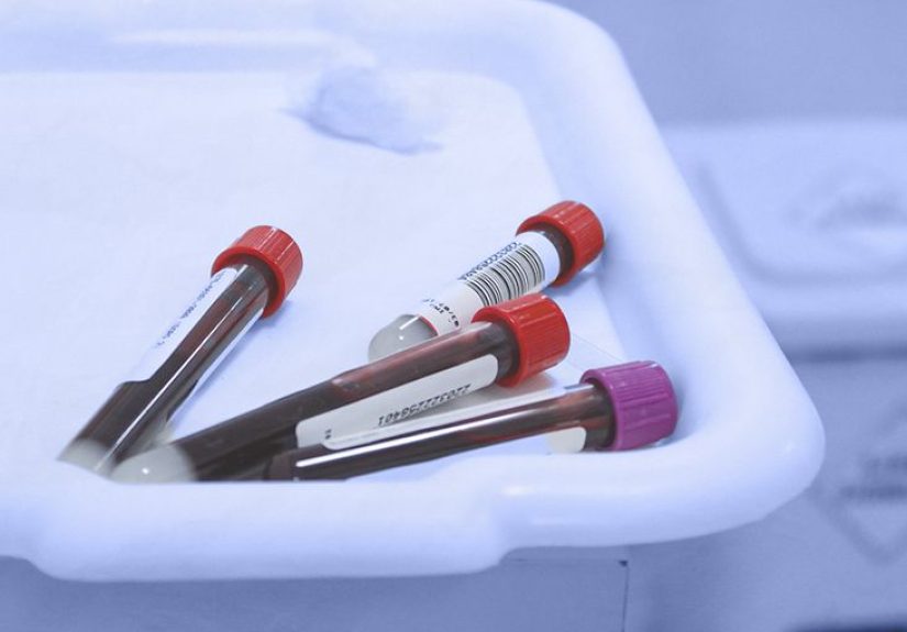 Tests for Uterine Cancer: How It Is Diagnosed