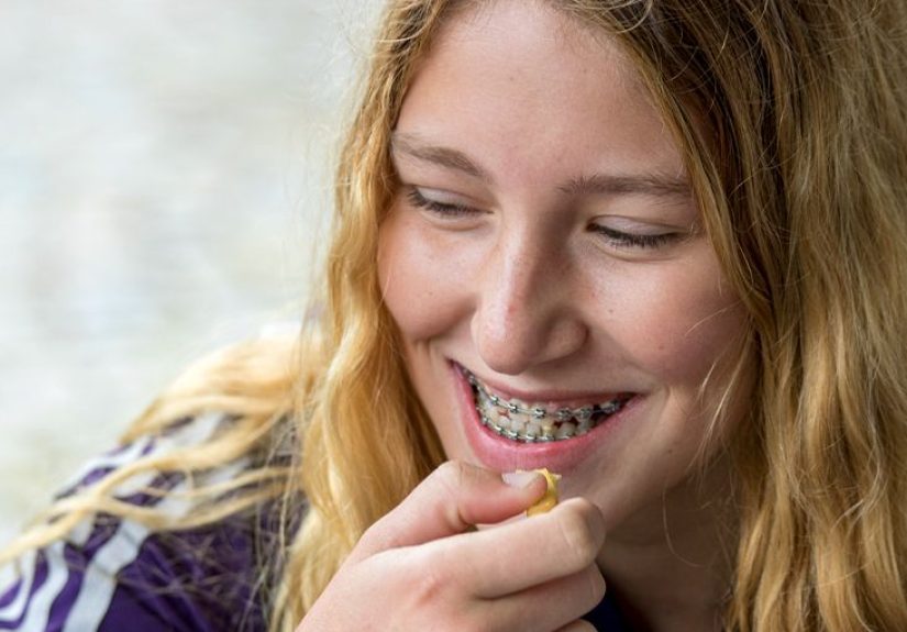 What Is Orthodontic Headgear and How Does It Help Straighten Teeth?